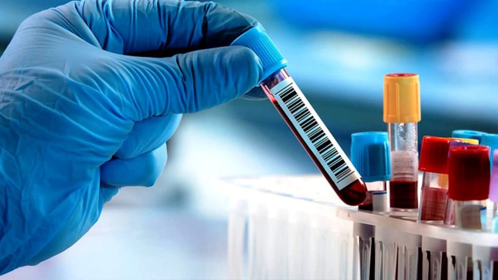 RDE 30 octubre 2026 - Sífilis: por qué puede repetirse la infección y cuándo consultar Sífilis: por qué puede repetirse la infección y cuándo consultar