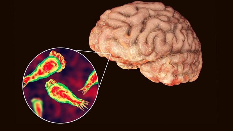 Murió un nene de 10 años por una ameba que ataca el cerebro: cómo prevenir el contagio